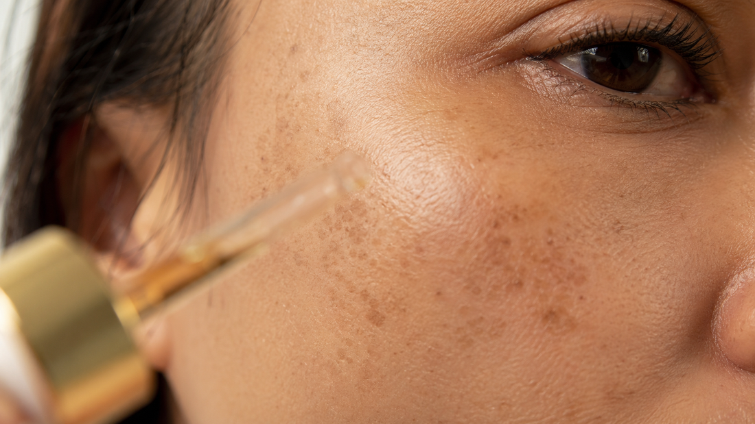 How to Fade Dark Spots with Vitamin C Serum